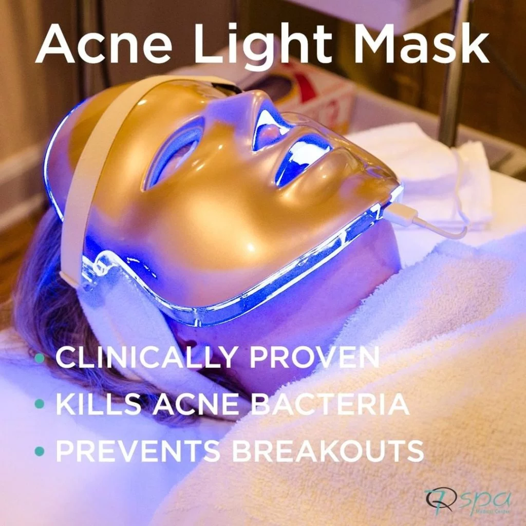 Acne Facial - 7Q Spa - Acne Facial Burbank